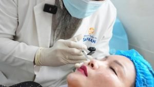 Phẫu Thuật Thẩm Mỹ Mặt