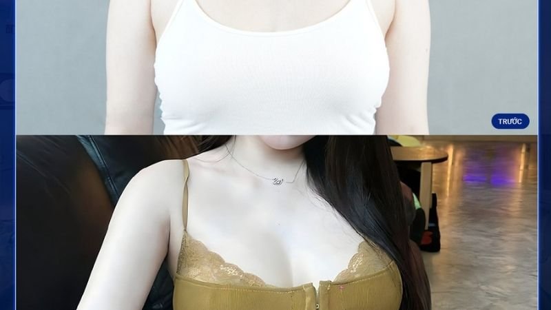 Địa Chỉ Làm Đẹp Uy Tín Tại Quận 10