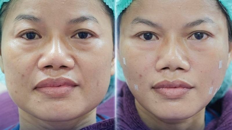 Trải nghiệm thực tế của khách hàng