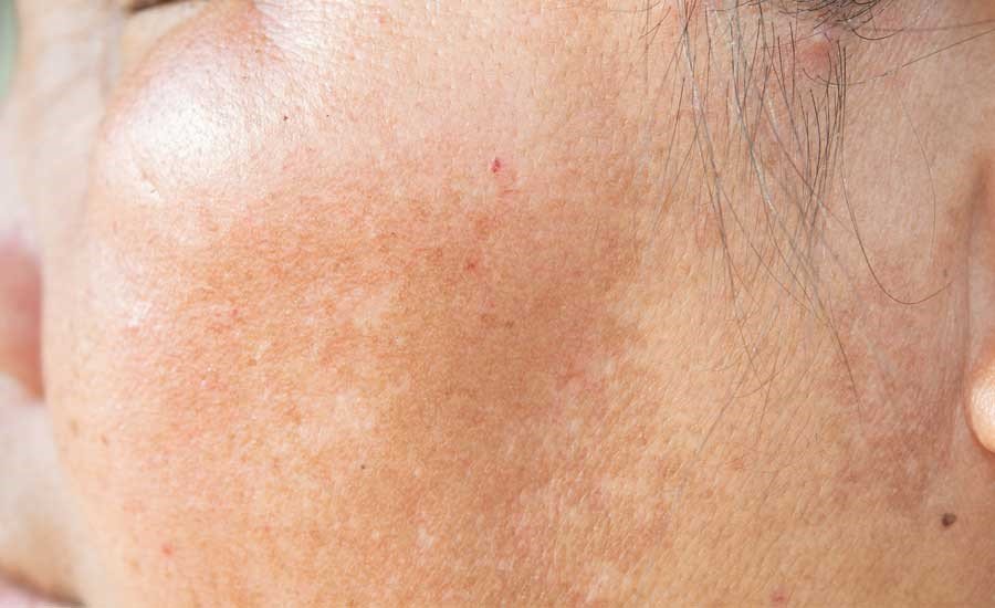 Chăm sóc da sau sinh an toàn chuẩn y tế tại Sao Hàn