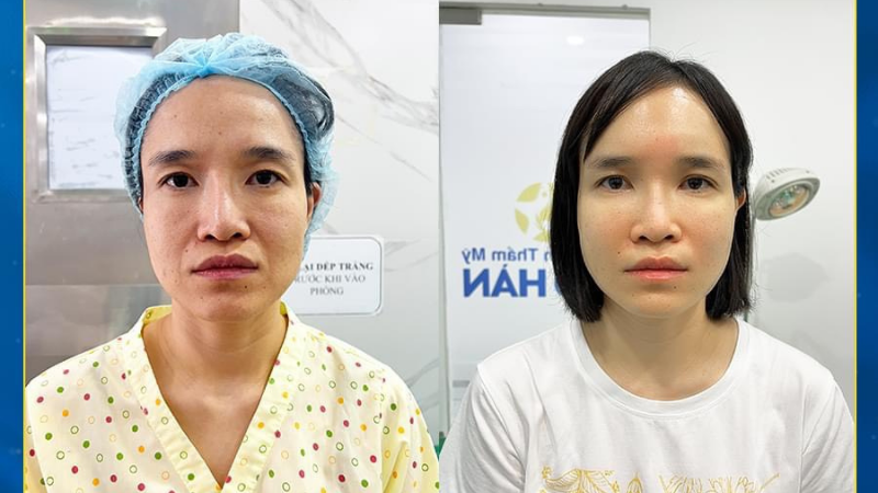 Chăm sóc da sau sinh an toàn chuẩn y tế tại Sao Hàn