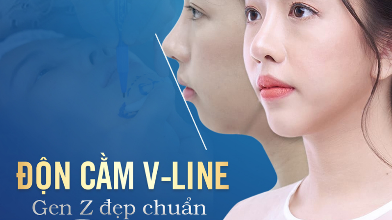 Khách hàng trước và sau chỉnh hàm lệch