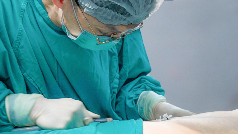 Dịch vụ hút mỡ toàn thân: Xu Hướng Mới 2025