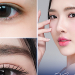 Tạo mí đôi tự nhiên
