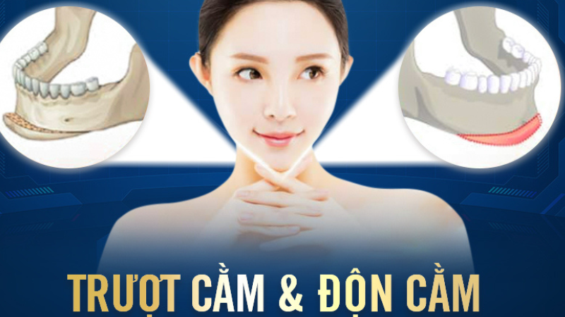Dịch vụ tạo hình gương mặt V-line - Giải pháp làm đẹp không thể bỏ lỡ