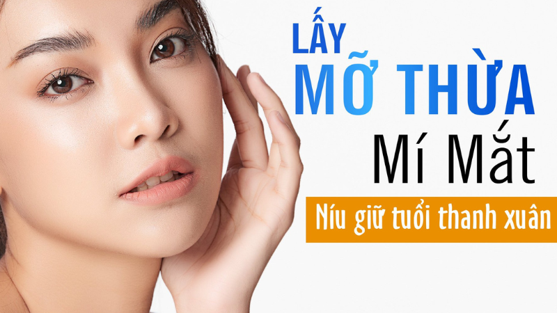 Lấy mỡ mí mắt trên – Làm ở đâu uy tín tại TP.HCM